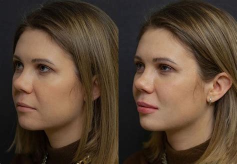 Stylage M (Стилейдж М) для губ. Цена, отзывы — Женские Секреты: красота ...