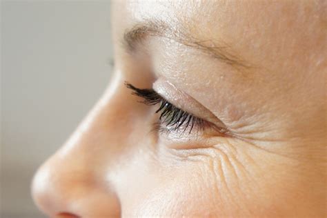 How to get rid of mimic wrinkles under the eyes? – Alpika Cosmetics