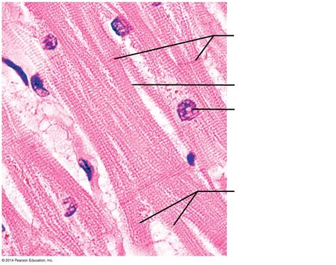 Cardiac Muscle Tissue Labeled Bifurcation - pic-earwax