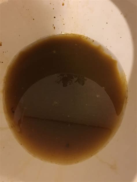 Another day, another diarrhea. Is this color worrying? : r/poop