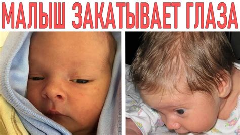 ЗАКАТЫВАНИЕ ГЛАЗ У НОВОРОЖДЕННЫХ | Почему новорожденные закатывают ...