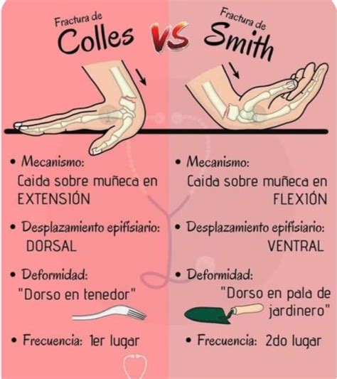 diferencia entre fractura de colles fractura de smith blog de