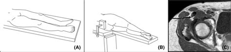 The anterolateral approach is performed in either the supine or lateral ...