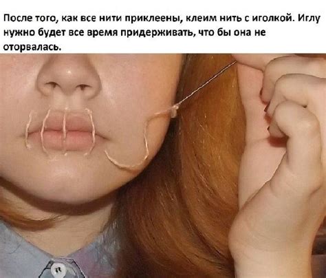 Как зашить себе рот