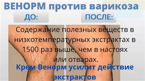 Крем Венорм - YouTube