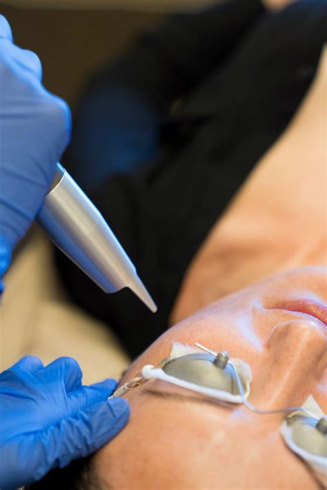 face  laser skincare series part   benefits  laser skincare