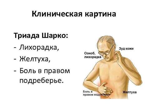 Острый холангит Презентацию подготовил Селезнев М Ю студент