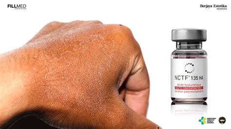 mengatasi punggung tangan keriput  kusam