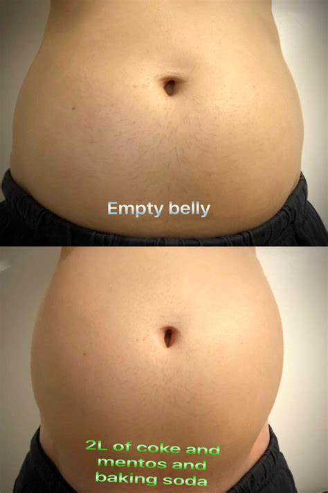 Coke Bloat Before And After