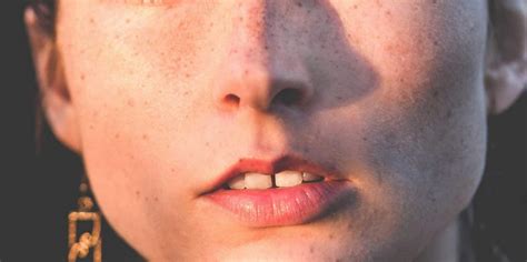 gap teeth fix   fix gaps  teeth  home dental veneers