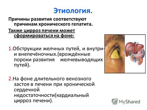 Презентация на тему: "Презентация Тема: «Цирроз печени». Цирроз печени ...