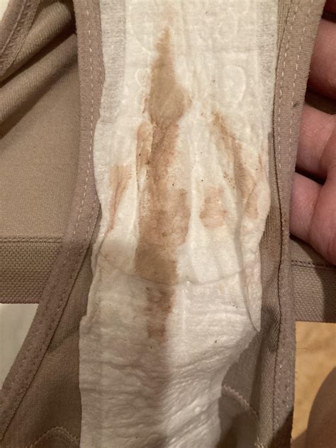Am I supposed to have this much discharge? : r/Periods