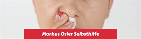 Morbus Osler Selbsthilfe