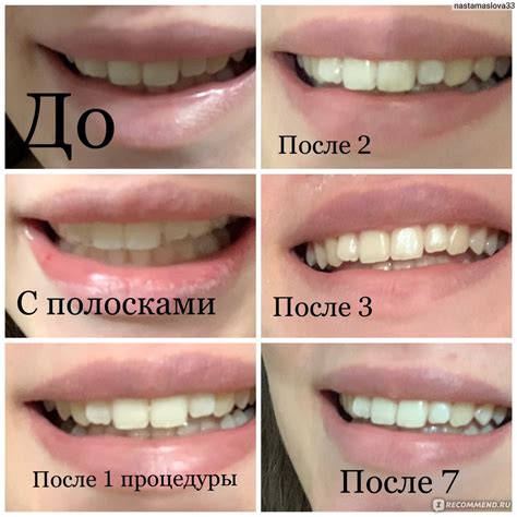 Отбеливающие полоски для зубов Smilebe Pro - «Результат есть» | отзывы