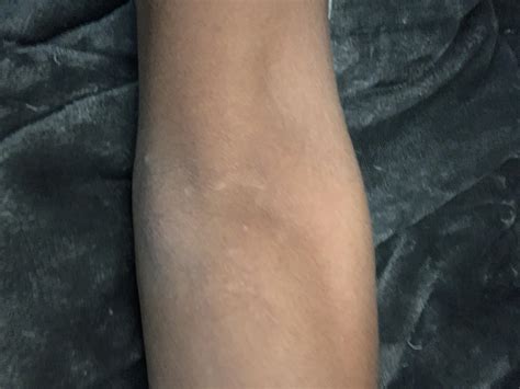 My elbow hurts here is a picture : r/notinteresting