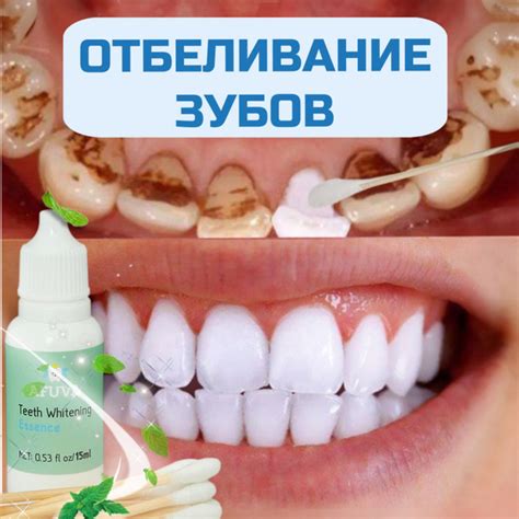 Отбеливание зубов AFUVA гель для домашнего отбеливания зубов, 15мл ...