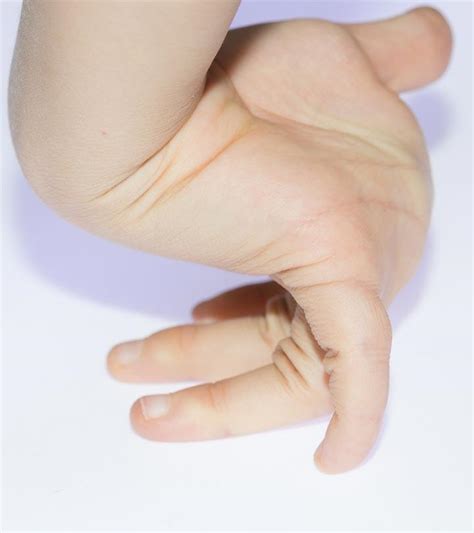 ways  prevent tic  child types  dadzcom