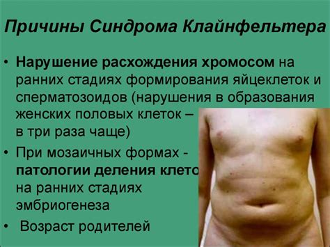 Синдром Клайнфельтера - презентация онлайн