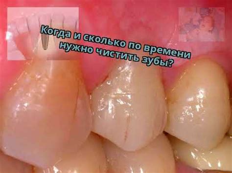 Когда и сколько по времени нужно чистить зубы? - YouTube