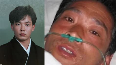 The Tragic Story of Hisashi Ouchi Photos: A Cautionary Tale of ...