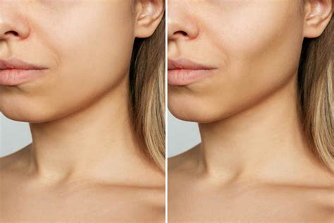 Ozempic Face | Is it True? | SAVE 60% on Ozempic Weight Loss