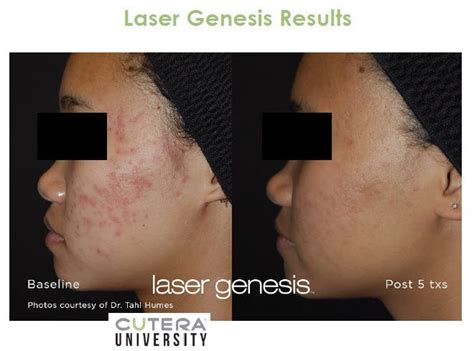 laser treatments adelaide cosmetic medicine laser skin clinic