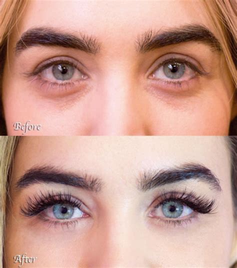 Eyelash Extensions Before And After