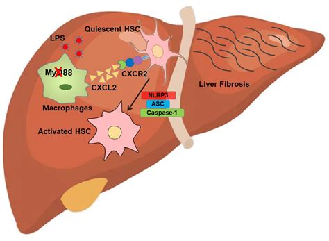 IJMS | Free Full-Text | MyD88 in Macrophages Enhances Liver Fibrosis by ...