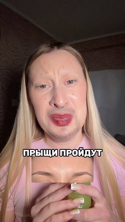 Сыворотка от прыщей - 142054898 (вб) #какубратьпрыщи #прыщи # ...