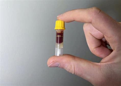 Numan blood test review: I survived