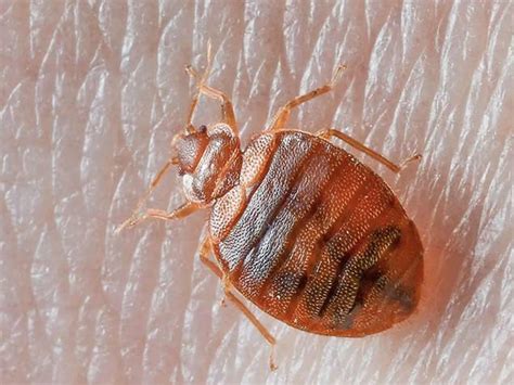 bed bugs bed bug bites    rid  bed bugs