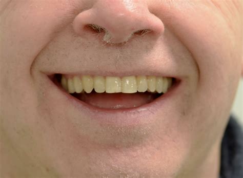 Revealing a Bolder You with Orthodontic Care in Peterborough