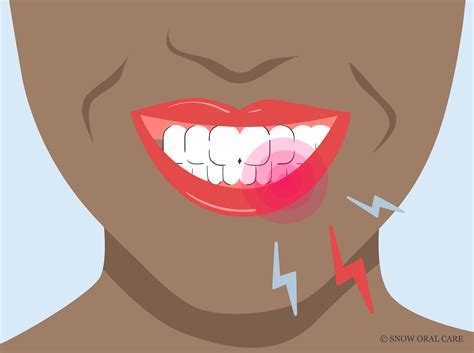 Best Toothbrush for Sensitive Gums: SNOWs Expert Choice