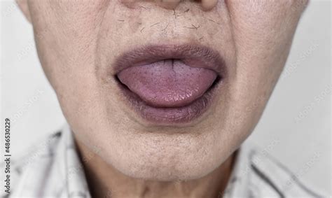 cyanosis   lips lipstutorialorg
