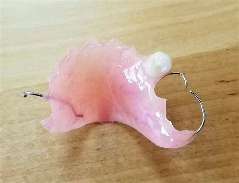 Flipper Partial - CAE Dental