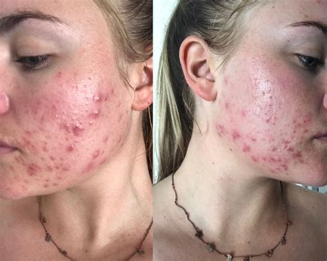 Hormone Testing: A Key to Balancing Your Wellbeing