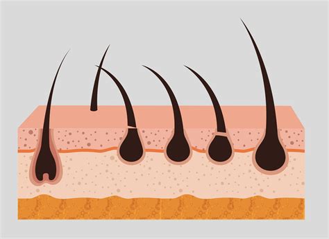 hair graft cost 7