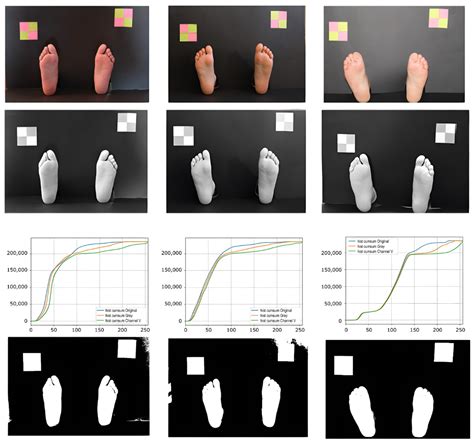 Automatic Segmentation of Monofilament Testing Sites in Plantar Images
