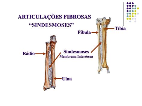 A Sindesmose é Uma Sinartrose Encontrada Na Articulação Tibiofibular