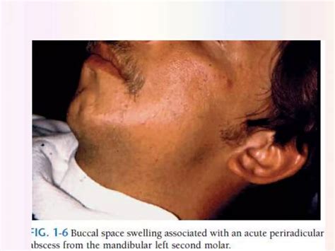 Diagnosis of pulpal pathology ( Abdullah karamat ) | PPTX