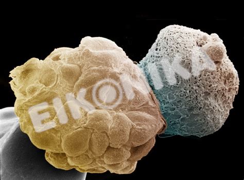 day 6 hatching human blastocyst – Eikonika.net