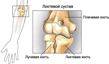 Перелом локтя - Описание, диагностика, лечение болезней