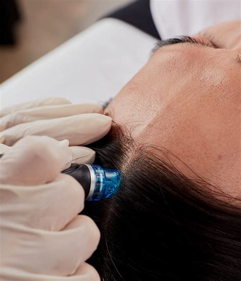 HydraFacial Keravive Treatment | Hair Loss Treatment | Dr Yusra