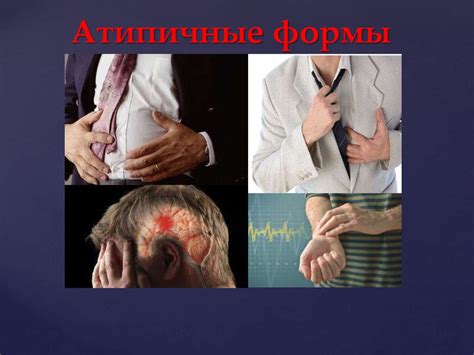 Атипичные формы инфаркта миокарда - презентация онлайн