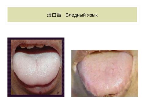 Традиционная диагностика по языку - online presentation