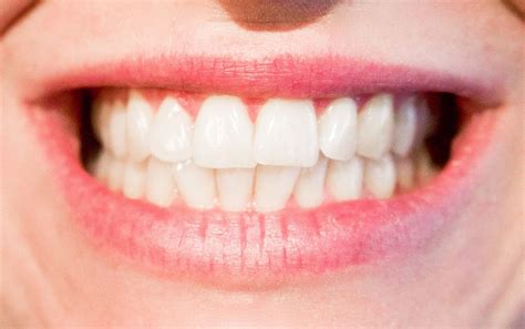 teeth        medium