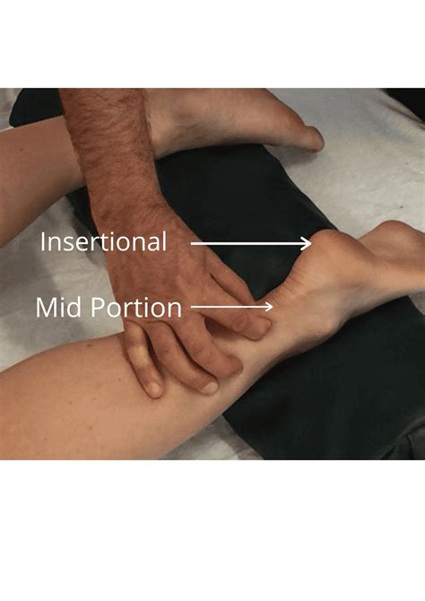 Achilles Tendinopathy: A common injury with a simple approach. - SES