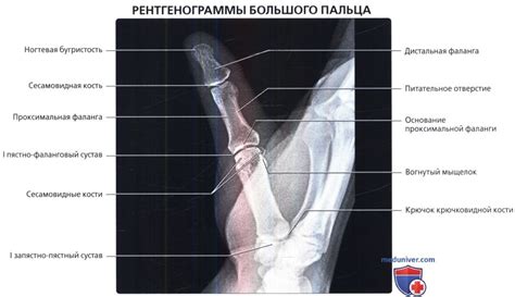 Рентгенограмма кисти в норме