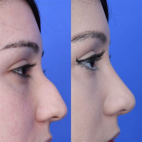 Westlake Plastic Surgery - Home | Facebook