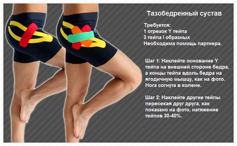 Правила тейпирования тазобедренного сустава и отзывы об эффективности